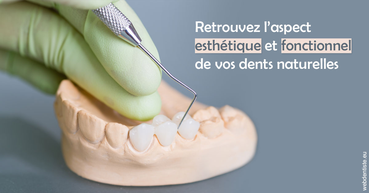 https://selarl-cabinet-dentaire-la-passerelle.chirurgiens-dentistes.fr/Restaurations dentaires 1