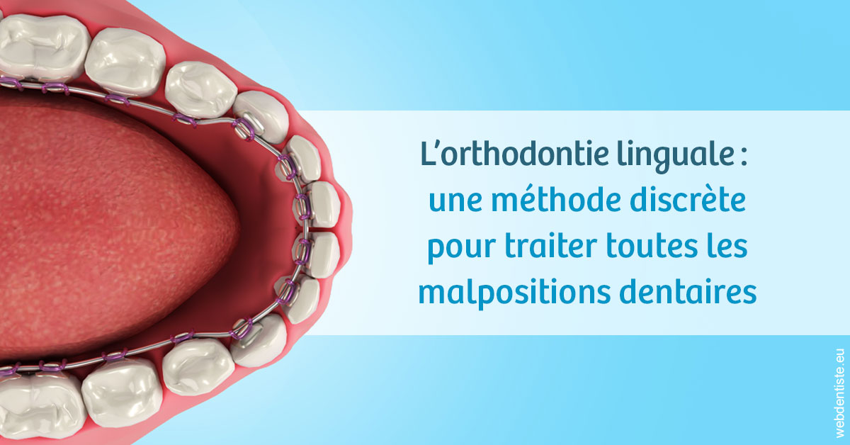 https://selarl-cabinet-dentaire-la-passerelle.chirurgiens-dentistes.fr/L'orthodontie linguale 1