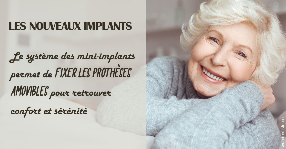https://selarl-cabinet-dentaire-la-passerelle.chirurgiens-dentistes.fr/Les nouveaux implants 1