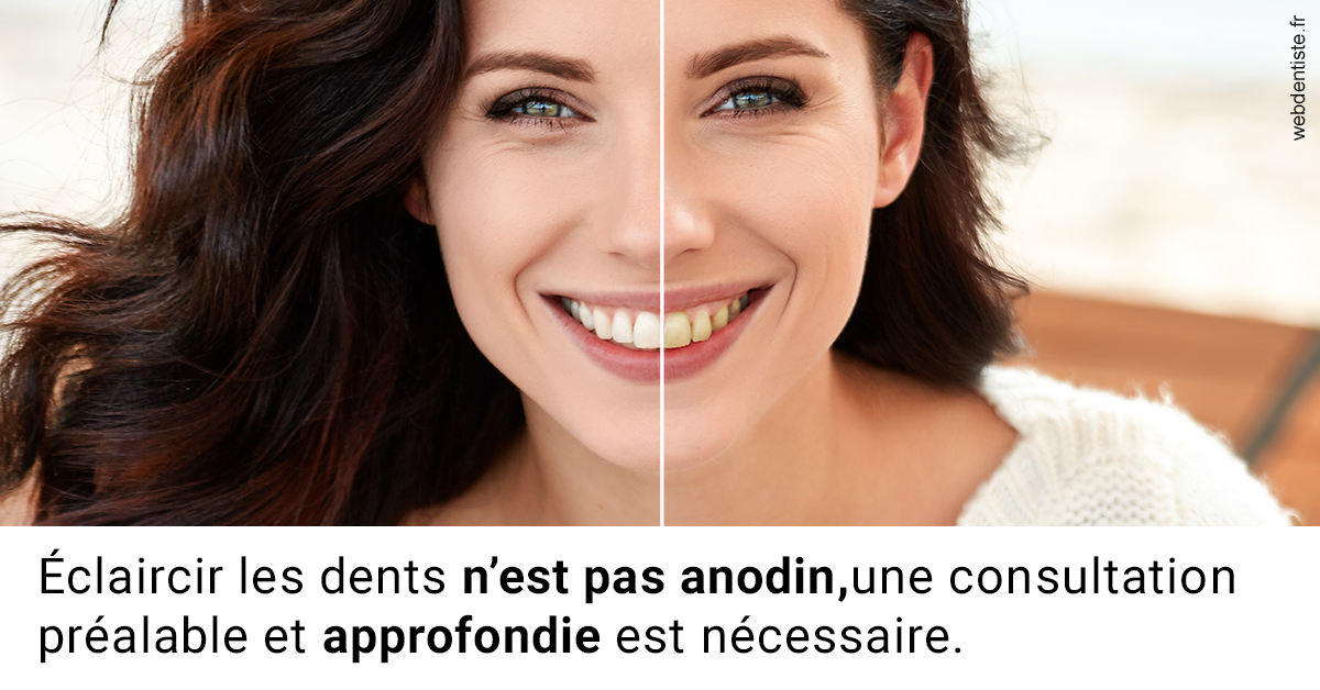 https://selarl-cabinet-dentaire-la-passerelle.chirurgiens-dentistes.fr/Le blanchiment 2