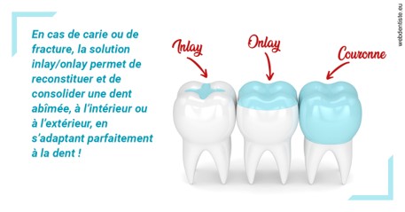 https://selarl-cabinet-dentaire-la-passerelle.chirurgiens-dentistes.fr/L'INLAY ou l'ONLAY