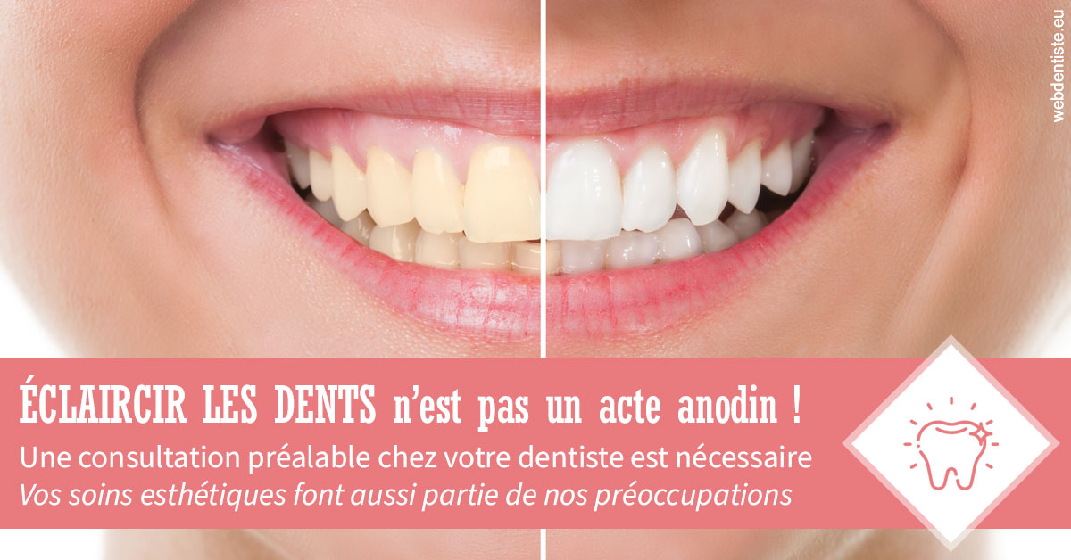 https://selarl-cabinet-dentaire-la-passerelle.chirurgiens-dentistes.fr/Eclaircir les dents 1