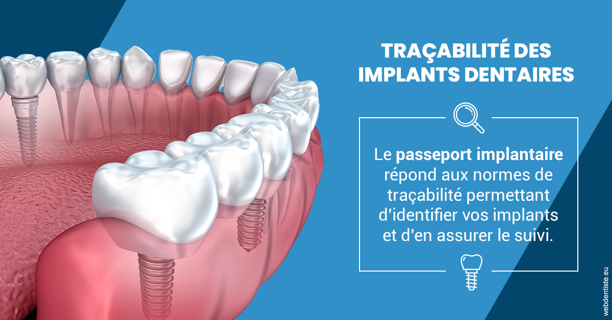 https://selarl-cabinet-dentaire-la-passerelle.chirurgiens-dentistes.fr/T2 2023 - Traçabilité des implants 1