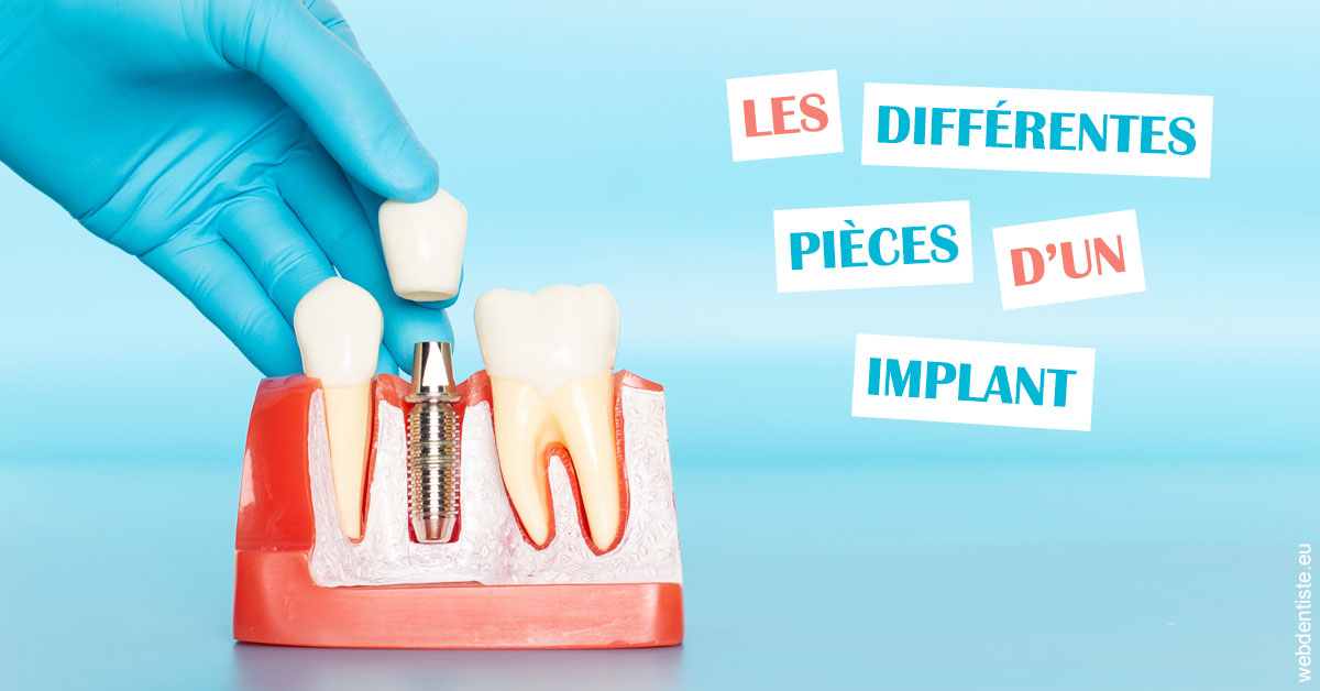 https://selarl-cabinet-dentaire-la-passerelle.chirurgiens-dentistes.fr/Les différentes pièces d’un implant 2