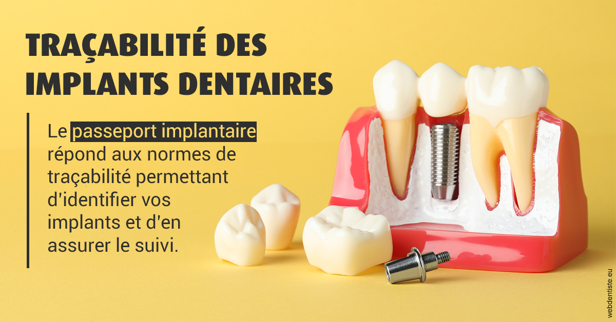 https://selarl-cabinet-dentaire-la-passerelle.chirurgiens-dentistes.fr/T2 2023 - Traçabilité des implants 2