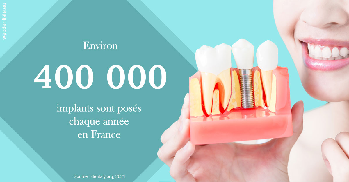 https://selarl-cabinet-dentaire-la-passerelle.chirurgiens-dentistes.fr/Pose d'implants en France 2