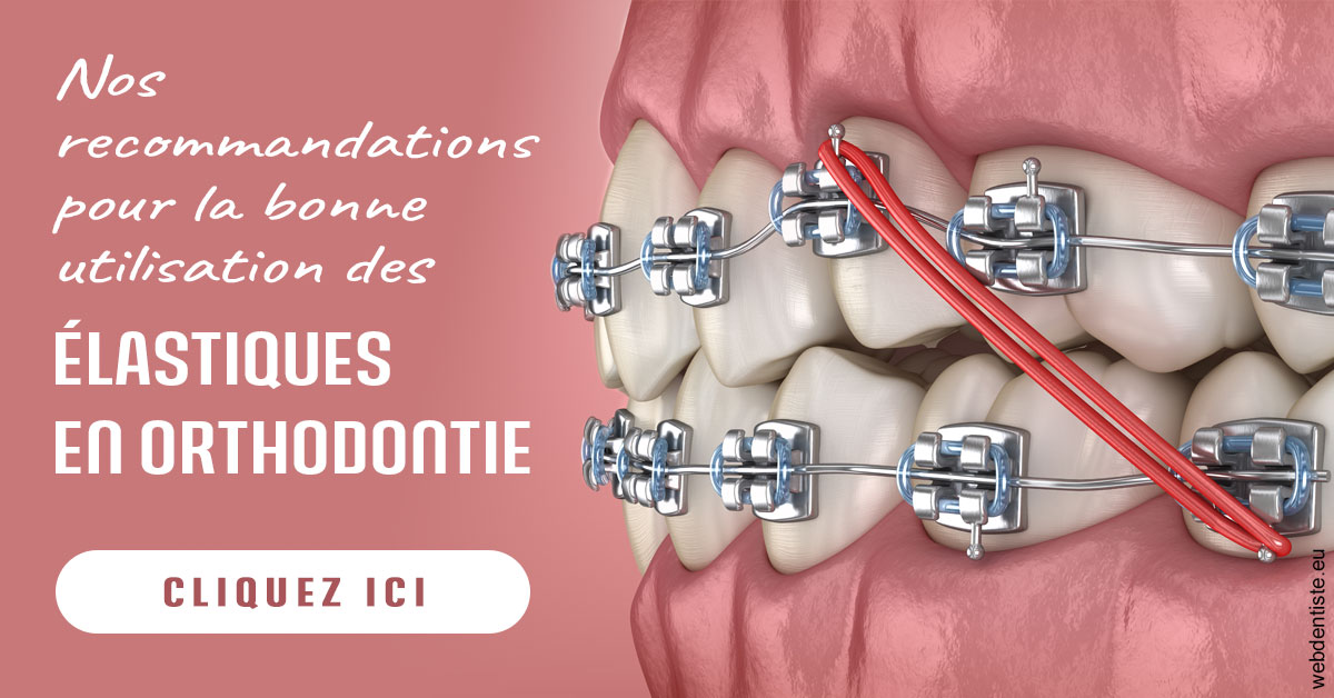https://selarl-cabinet-dentaire-la-passerelle.chirurgiens-dentistes.fr/Elastiques orthodontie 2